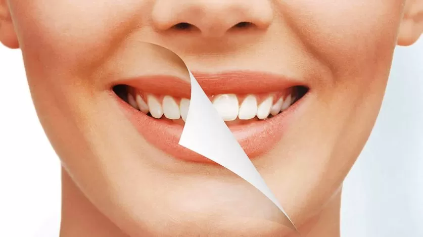 Tooth Contouring